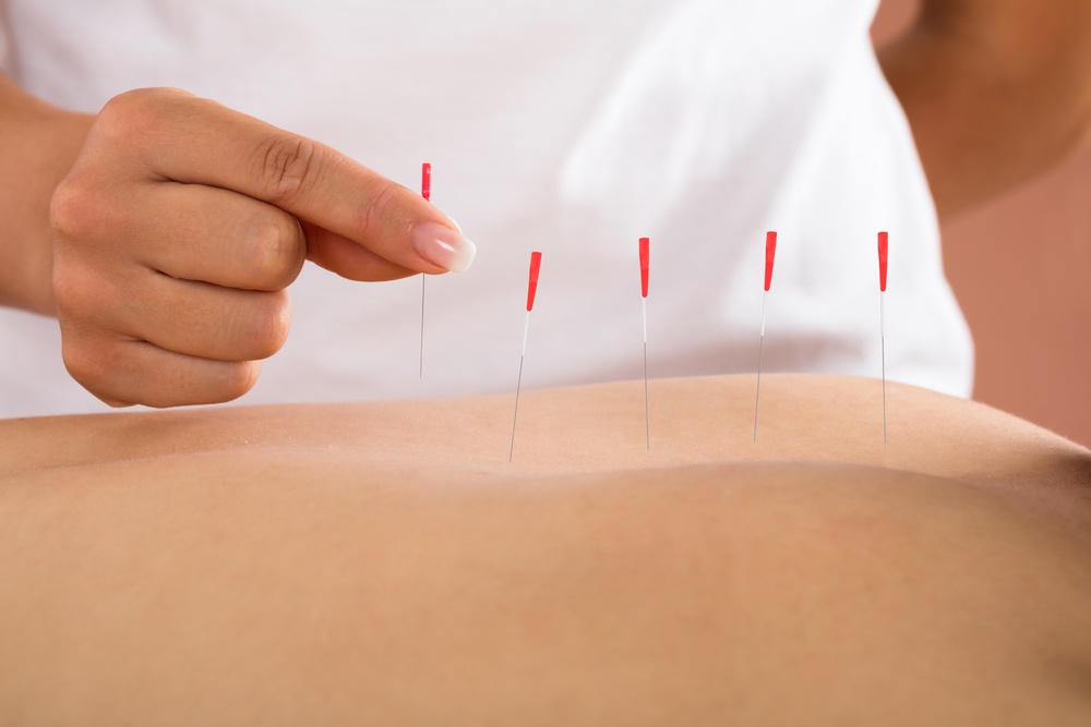 acupuncture_help_get_pregnant